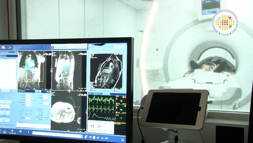 Investigație avansată pentru diagnostic în cardiologie, disponibilă la Spitalul „Victor Babeș” din Timișoara Investigație avansată pentru diagnostic în cardiologie, disponibilă la Spitalul „Victor Babeș” din Timișoara